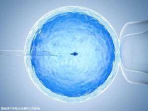冷冻存储